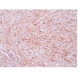 Immunohistochemistry - Anti-ALK Antibody [ALK1/7008R] - BSA and Azide free (A278574) - Antibodies.com