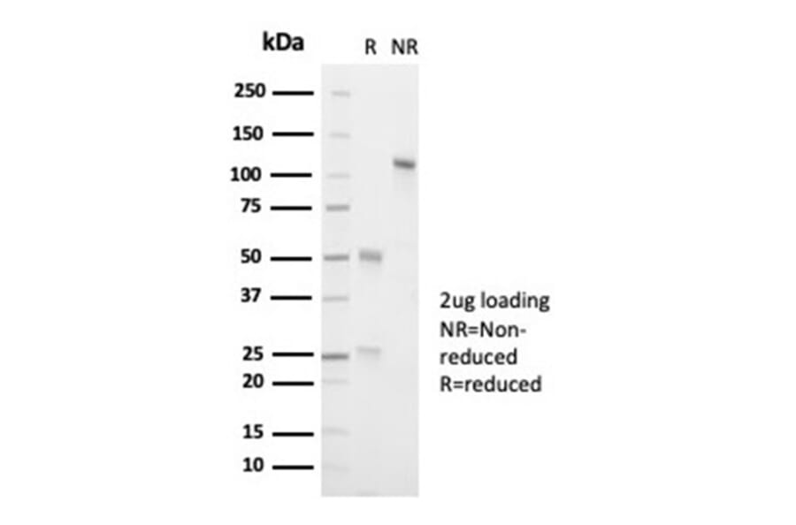 SDS-PAGE - Anti-ALK Antibody [ALK1/7008R] - BSA and Azide free (A278574) - Antibodies.com