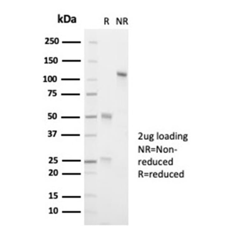 SDS-PAGE - Anti-ALK Antibody [ALK1/7008R] - BSA and Azide free (A278574) - Antibodies.com