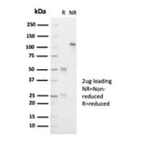 SDS-PAGE - Anti-ALK Antibody [ALK1/7008R] - BSA and Azide free (A278574) - Antibodies.com