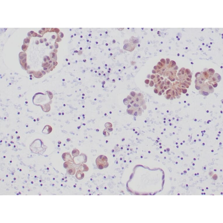 Immunohistochemistry - Anti-ALK Antibody [ALK1/6698R] - BSA and Azide free (A278575) - Antibodies.com