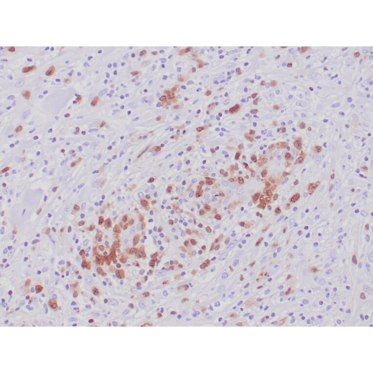 Immunohistochemistry - Anti-ALK Antibody [ALK1/6698R] - BSA and Azide free (A278575) - Antibodies.com