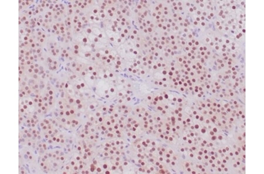 Immunohistochemistry - Anti-Steroidogenic Factor 1 Antibody [NR5A1/4368R] - BSA and Azide free (A278576) - Antibodies.com