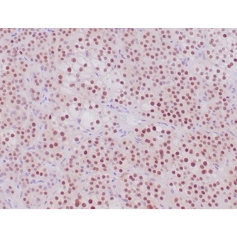 Immunohistochemistry - Anti-Steroidogenic Factor 1 Antibody [NR5A1/4368R] - BSA and Azide free (A278576) - Antibodies.com