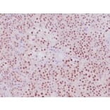 Immunohistochemistry - Anti-Steroidogenic Factor 1 Antibody [NR5A1/4368R] - BSA and Azide free (A278576) - Antibodies.com