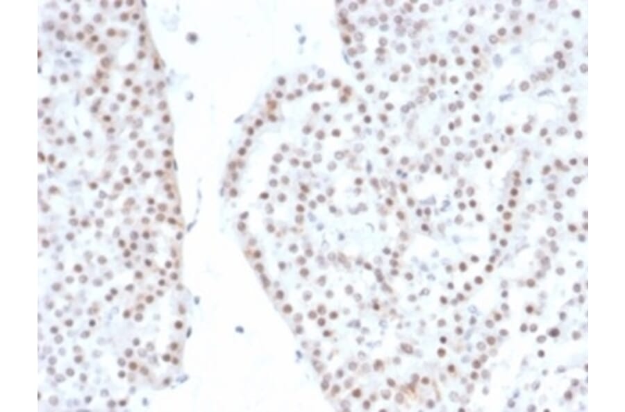 Immunohistochemistry - Anti-Steroidogenic Factor 1 Antibody [NR5A1/4368R] - BSA and Azide free (A278576) - Antibodies.com