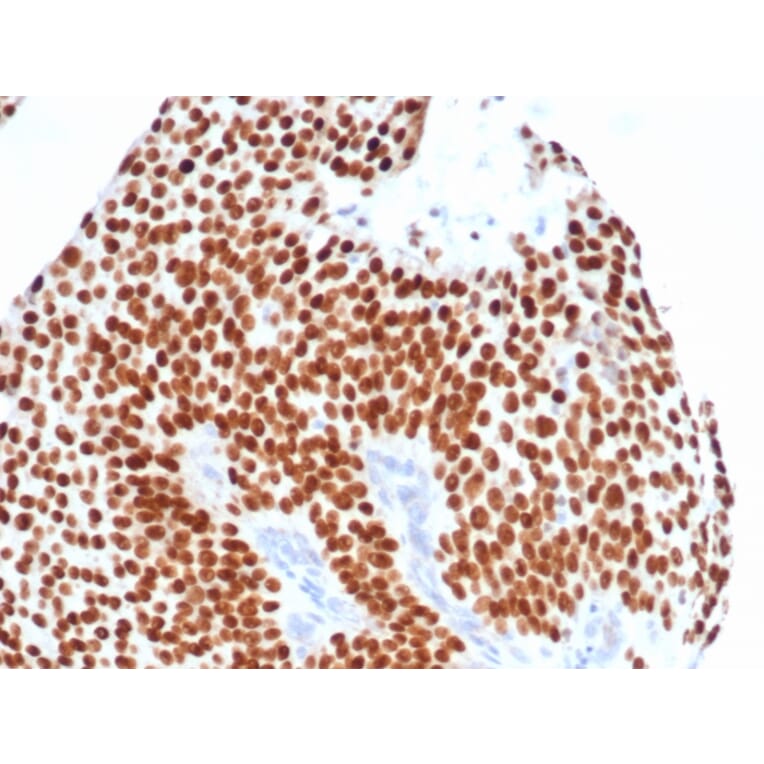 Immunohistochemistry - Anti-GATA3 Antibody [GATA3/4550R] - BSA and Azide free (A278577) - Antibodies.com