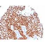 Immunohistochemistry - Anti-GATA3 Antibody [GATA3/4550R] - BSA and Azide free (A278577) - Antibodies.com