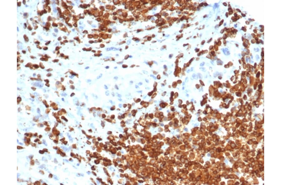 Immunohistochemistry - Anti-AMH Antibody [AMH/6713R] - BSA and Azide free (A278578) - Antibodies.com