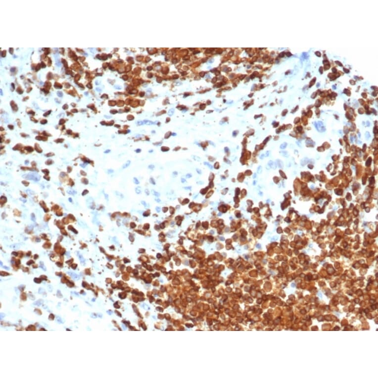 Immunohistochemistry - Anti-AMH Antibody [AMH/6713R] - BSA and Azide free (A278578) - Antibodies.com