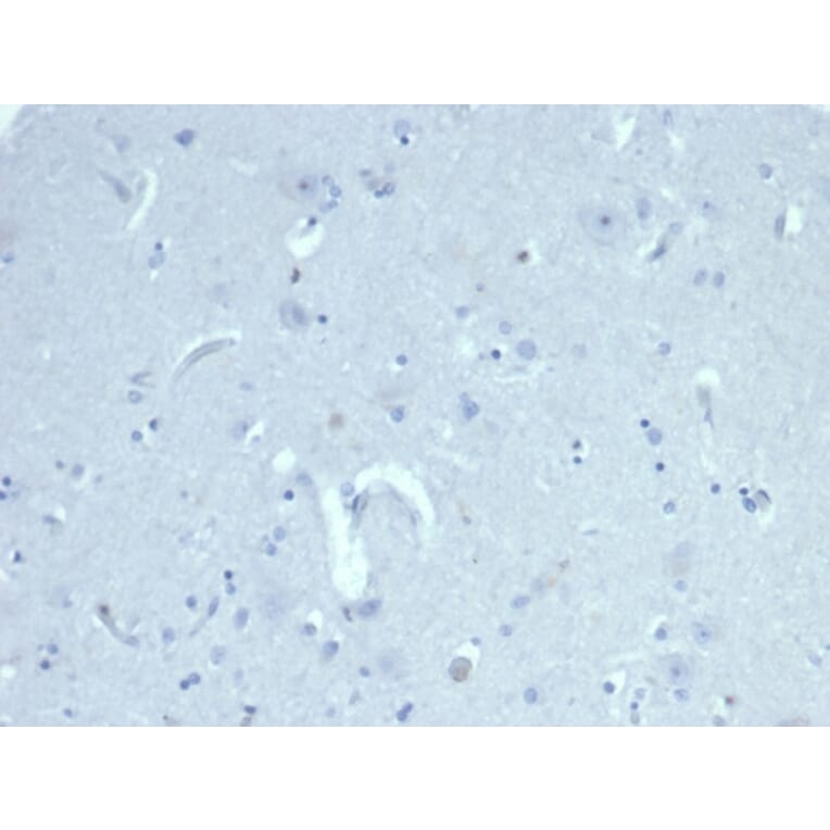 Immunohistochemistry - Anti-AMH Antibody [AMH/6713R] - BSA and Azide free (A278578) - Antibodies.com