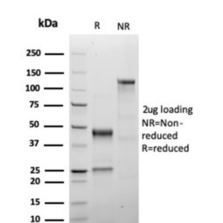 SDS-PAGE - Anti-Growth Hormone Antibody [GH/4886R] - BSA and Azide free (A278579) - Antibodies.com