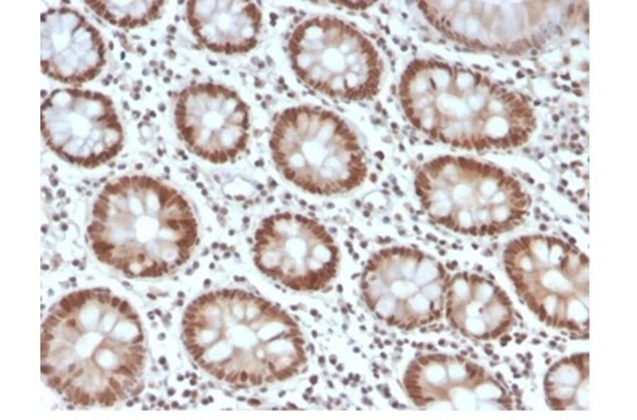 Immunohistochemistry - Anti-MSH6 Antibody [MSH6/4592R] - BSA and Azide free (A278580) - Antibodies.com