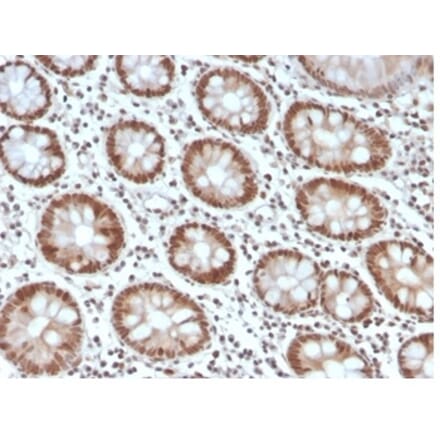 Immunohistochemistry - Anti-MSH6 Antibody [MSH6/4592R] - BSA and Azide free (A278580) - Antibodies.com