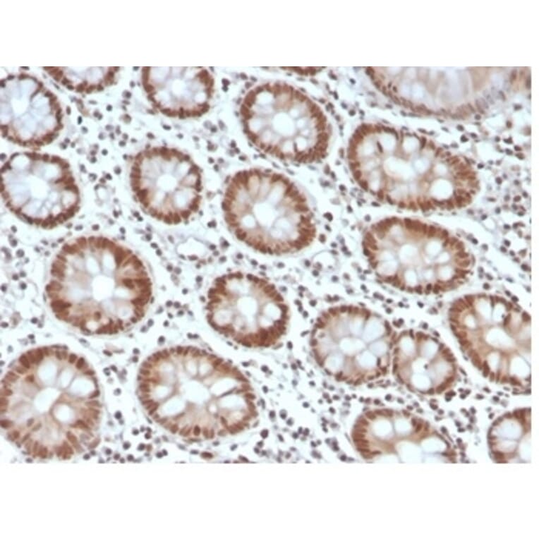 Immunohistochemistry - Anti-MSH6 Antibody [MSH6/4592R] - BSA and Azide free (A278580) - Antibodies.com