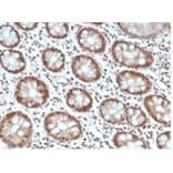 Immunohistochemistry - Anti-MSH6 Antibody [MSH6/4592R] - BSA and Azide free (A278580) - Antibodies.com