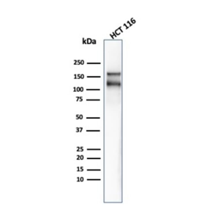 Western Blot - Anti-MSH6 Antibody [MSH6/4592R] - BSA and Azide free (A278580) - Antibodies.com