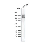 Western Blot - Anti-MSH6 Antibody [MSH6/4592R] - BSA and Azide free (A278580) - Antibodies.com
