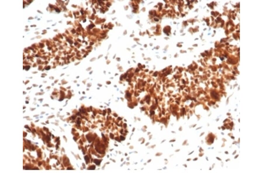Immunohistochemistry - Anti-MSH6 Antibody [MSH6/7065R] - BSA and Azide free (A278581) - Antibodies.com