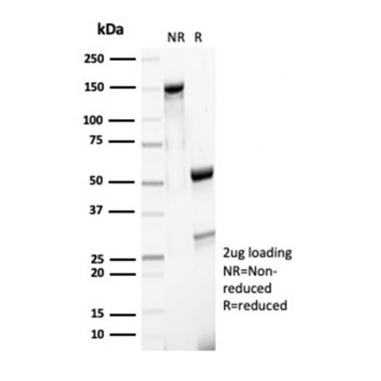 SDS-PAGE - Anti-MSH6 Antibody [MSH6/7065R] - BSA and Azide free (A278581) - Antibodies.com
