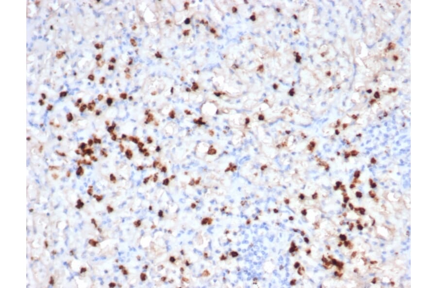 Immunohistochemistry - Anti-Granzyme B Antibody [GZMB/6530R] - BSA and Azide free (A278582) - Antibodies.com