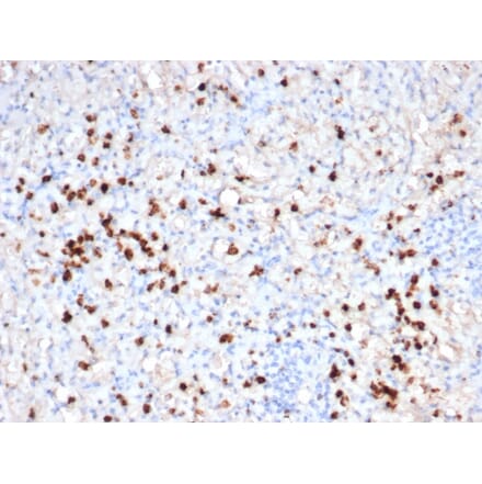 Immunohistochemistry - Anti-Granzyme B Antibody [GZMB/6530R] - BSA and Azide free (A278582) - Antibodies.com