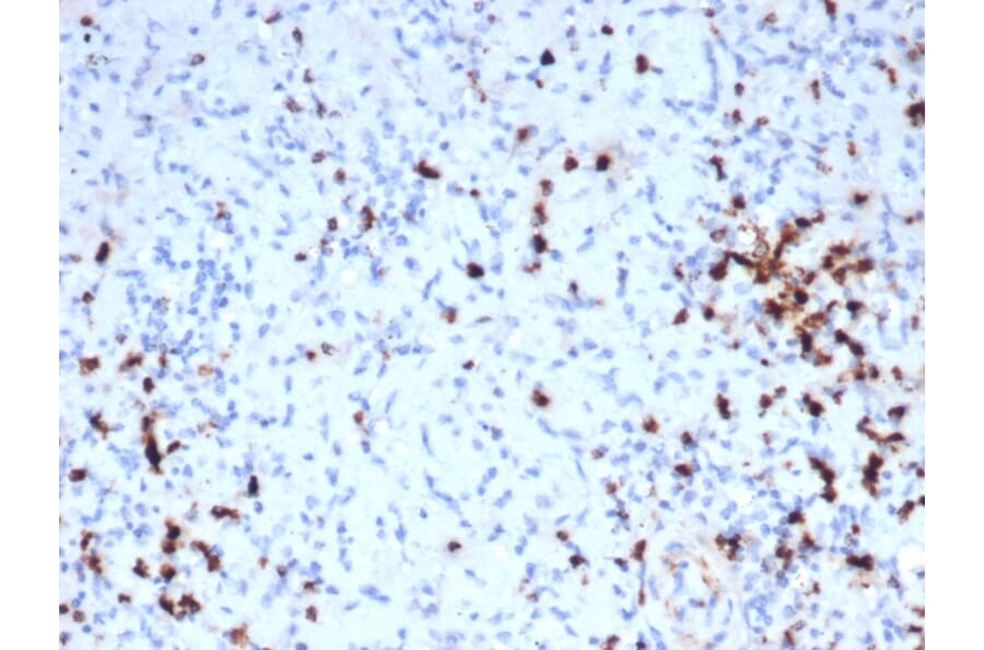 Immunohistochemistry - Anti-Granzyme B Antibody [GZMB/6530R] - BSA and Azide free (A278582) - Antibodies.com