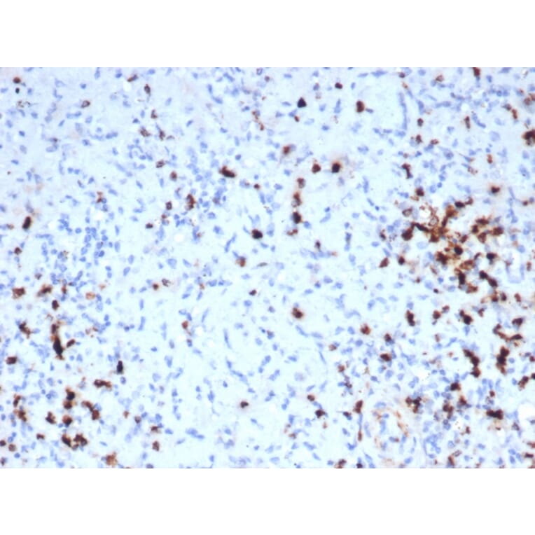 Immunohistochemistry - Anti-Granzyme B Antibody [GZMB/6530R] - BSA and Azide free (A278582) - Antibodies.com