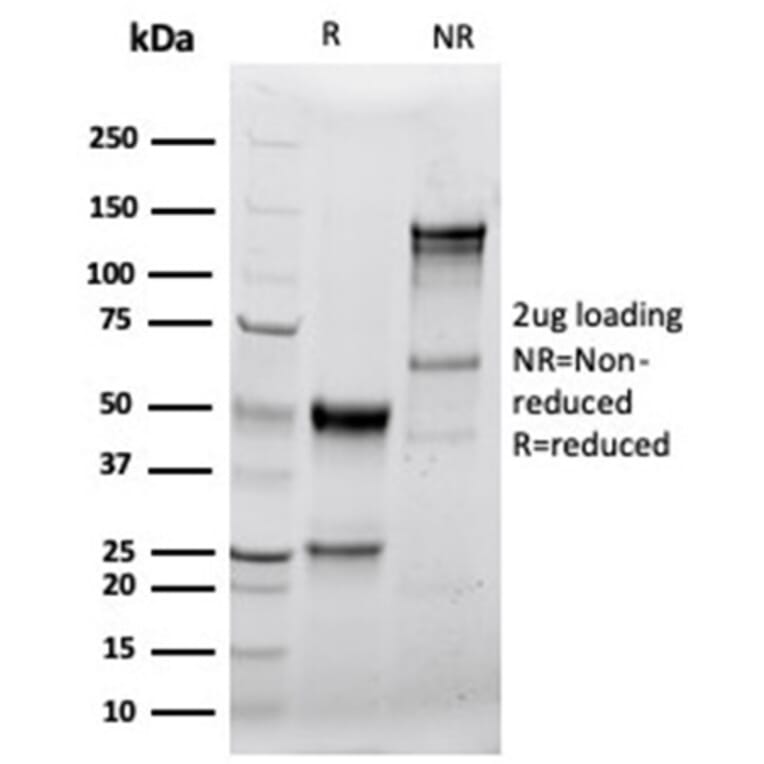 SDS-PAGE - Anti-Granzyme B Antibody [GZMB/4539R] - BSA and Azide free (A278583) - Antibodies.com