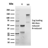 SDS-PAGE - Anti-Annexin A1 Antibody [ANXA1/6452R] - BSA and Azide free (A278584) - Antibodies.com