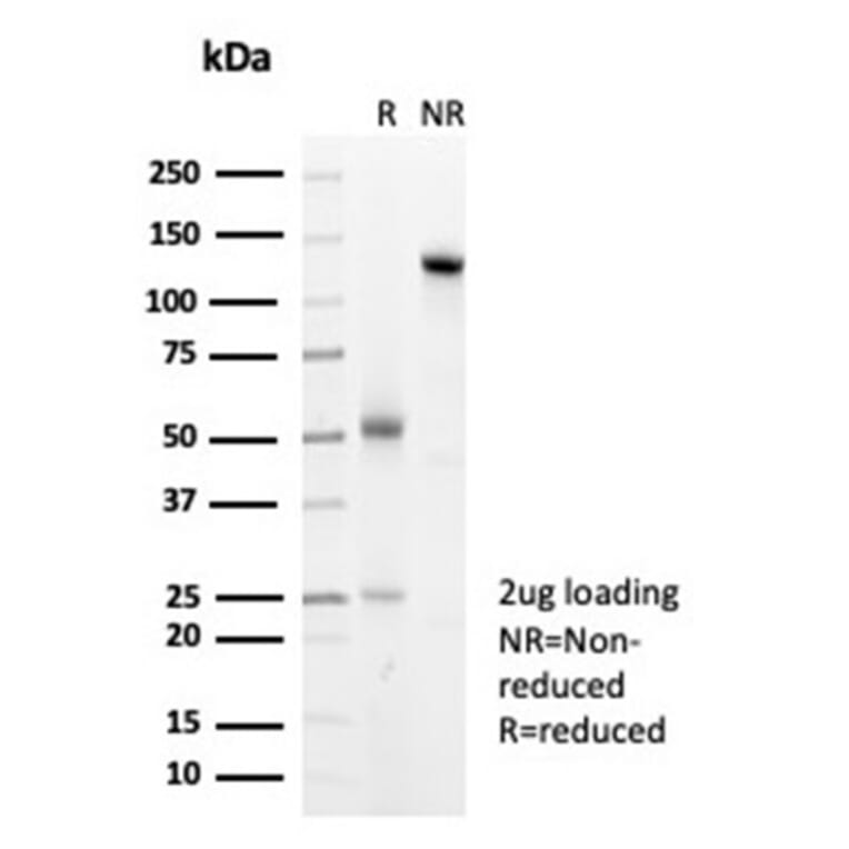 SDS-PAGE - Anti-HSP27 Antibody [HSPB1/7038R] - BSA and Azide free (A278585) - Antibodies.com