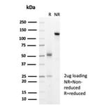 SDS-PAGE - Anti-HSP27 Antibody [HSPB1/7038R] - BSA and Azide free (A278585) - Antibodies.com