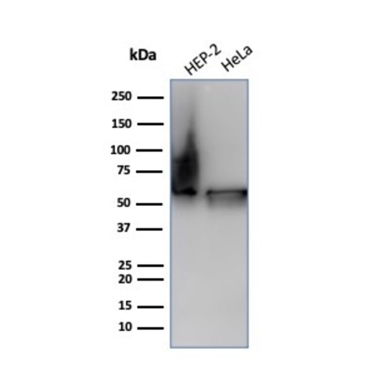Western Blot - Anti-HSP60 Antibody [HSPD1/6498R] - BSA and Azide free (A278586) - Antibodies.com