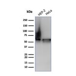 Western Blot - Anti-HSP60 Antibody [HSPD1/6498R] - BSA and Azide free (A278586) - Antibodies.com