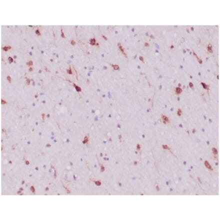 Immunohistochemistry - Anti-IDH1 (mutated R132H) Antibody [IDH1/6806R] - BSA and Azide free (A278587) - Antibodies.com