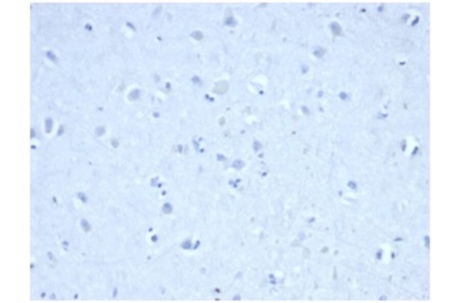 Immunohistochemistry - Anti-IDH1 (mutated R132H) Antibody [IDH1/6806R] - BSA and Azide free (A278587) - Antibodies.com