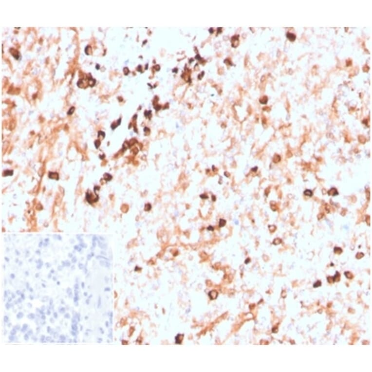 Immunohistochemistry - Anti-Lambda Light Chain Antibody [LLC/3774R] - BSA and Azide free (A278589) - Antibodies.com