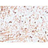 Immunohistochemistry - Anti-Lambda Light Chain Antibody [LLC/3774R] - BSA and Azide free (A278589) - Antibodies.com