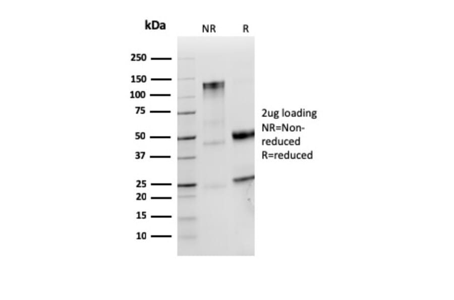 SDS-PAGE - Anti-Lambda Light Chain Antibody [LLC/3774R] - BSA and Azide free (A278589) - Antibodies.com