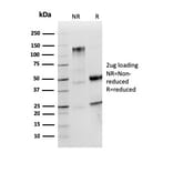 SDS-PAGE - Anti-Lambda Light Chain Antibody [LLC/3774R] - BSA and Azide free (A278589) - Antibodies.com