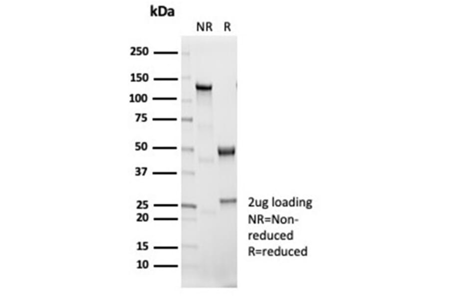 SDS-PAGE - Anti-IL-1 beta Antibody [IL1B/7049R] - BSA and Azide free (A278592) - Antibodies.com