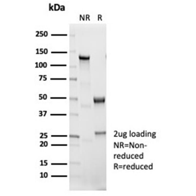 SDS-PAGE - Anti-IL-1 beta Antibody [IL1B/7049R] - BSA and Azide free (A278592) - Antibodies.com