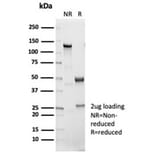 SDS-PAGE - Anti-IL-1 beta Antibody [IL1B/7049R] - BSA and Azide free (A278592) - Antibodies.com