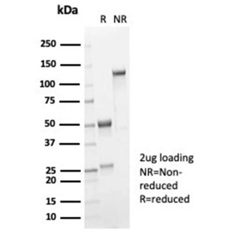 SDS-PAGE - Anti-IL-2 Antibody [IL2/7051R] - BSA and Azide free (A278593) - Antibodies.com