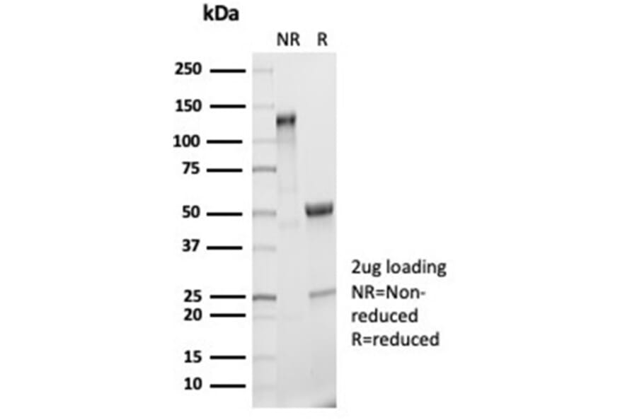 SDS-PAGE - Anti-IL-2 Antibody [IL2/7050R] - BSA and Azide free (A278594) - Antibodies.com