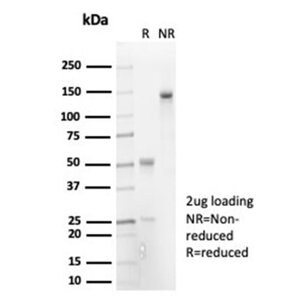 SDS-PAGE - Anti-IL-7 Antibody [IL7/7053R] - BSA and Azide free (A278595) - Antibodies.com