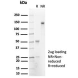 SDS-PAGE - Anti-IL-7 Antibody [IL7/7053R] - BSA and Azide free (A278595) - Antibodies.com