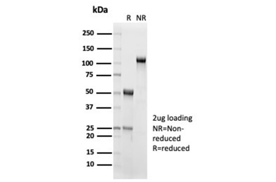 SDS-PAGE - Anti-IL-15 Antibody [IL15/7048R] - BSA and Azide free (A278596) - Antibodies.com