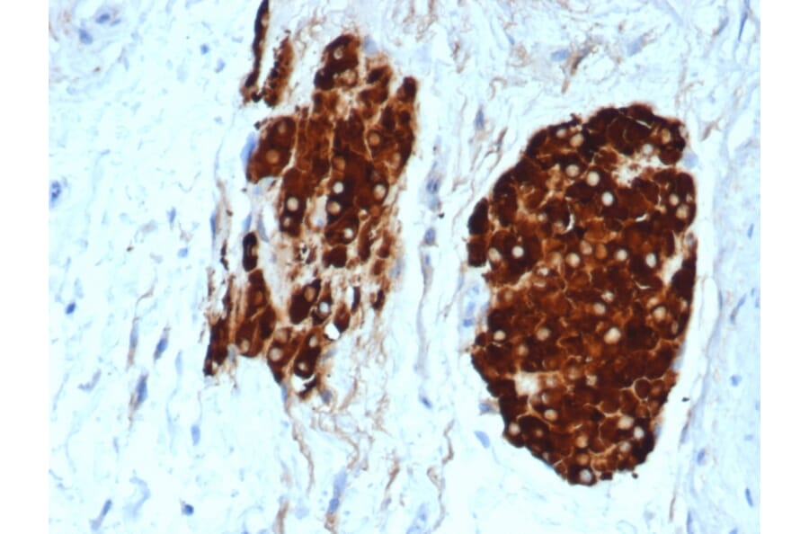 Immunohistochemistry - Anti-Inhibin alpha Antibody [INHA/6598R] - BSA and Azide free (A278598) - Antibodies.com