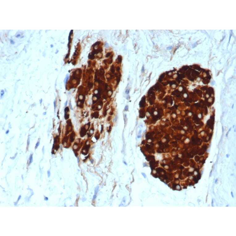 Immunohistochemistry - Anti-Inhibin alpha Antibody [INHA/6598R] - BSA and Azide free (A278598) - Antibodies.com